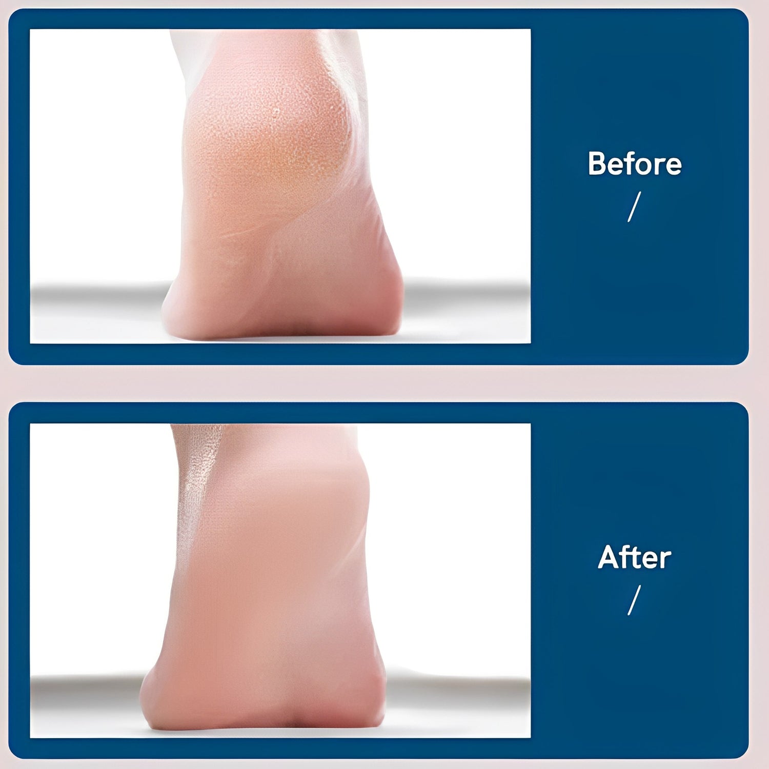 Before and after using foot wand! The results speak for themselves